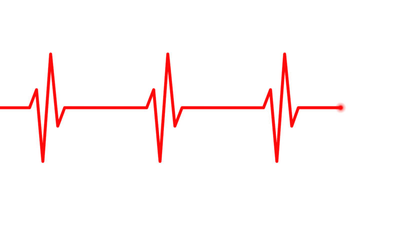 Elektrokardiogram, EKG, Kurve, Gesundheit, rot, #000152 | iXimus Vektor